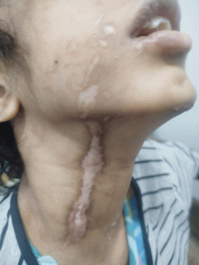 বিমানের এমডির বাসায় শিশু গৃহকর্মী নির্যাতন: মানবাধিকারের চরম লঙ্ঘন